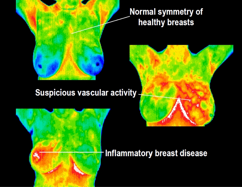 Why Both? Combination of Thermography and Ultrasound